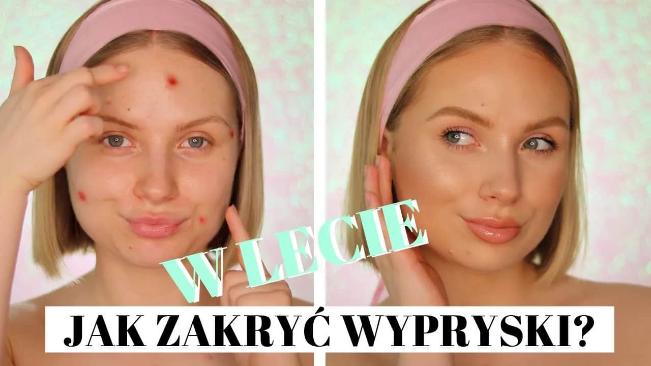 Pryszcze bez makijażu? Szybkie triki na natychmiastowy kamuflaż!