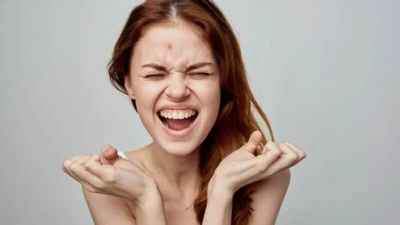 Nagły pryszcz? Ukryj go w 5 minut i wylecz przez noc!