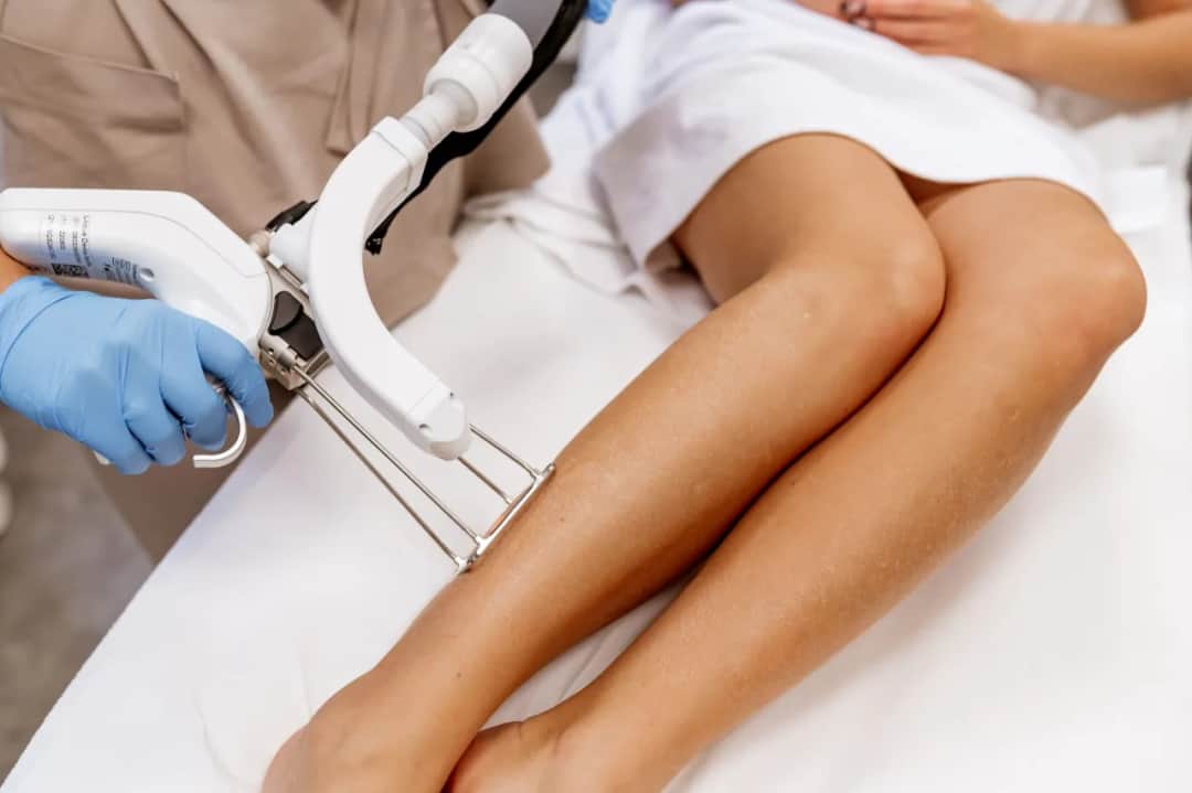 Ile zabiegów depilacji laserowej? Kompletny przewodnik Ewy Michalskiej